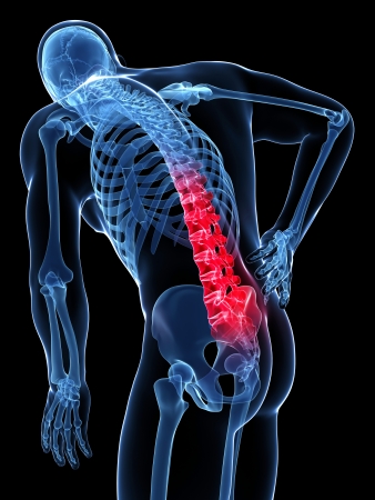 Low Back X-Rays - Beecher Chiropractic : Houston, TX Chiropractor