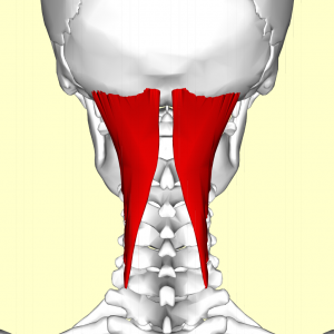 neck pain causes