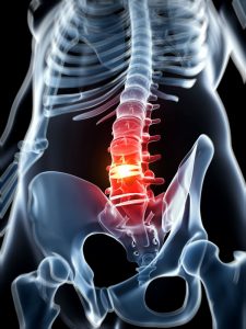 Radiografía para el dolor de espalda houston quiropráctico