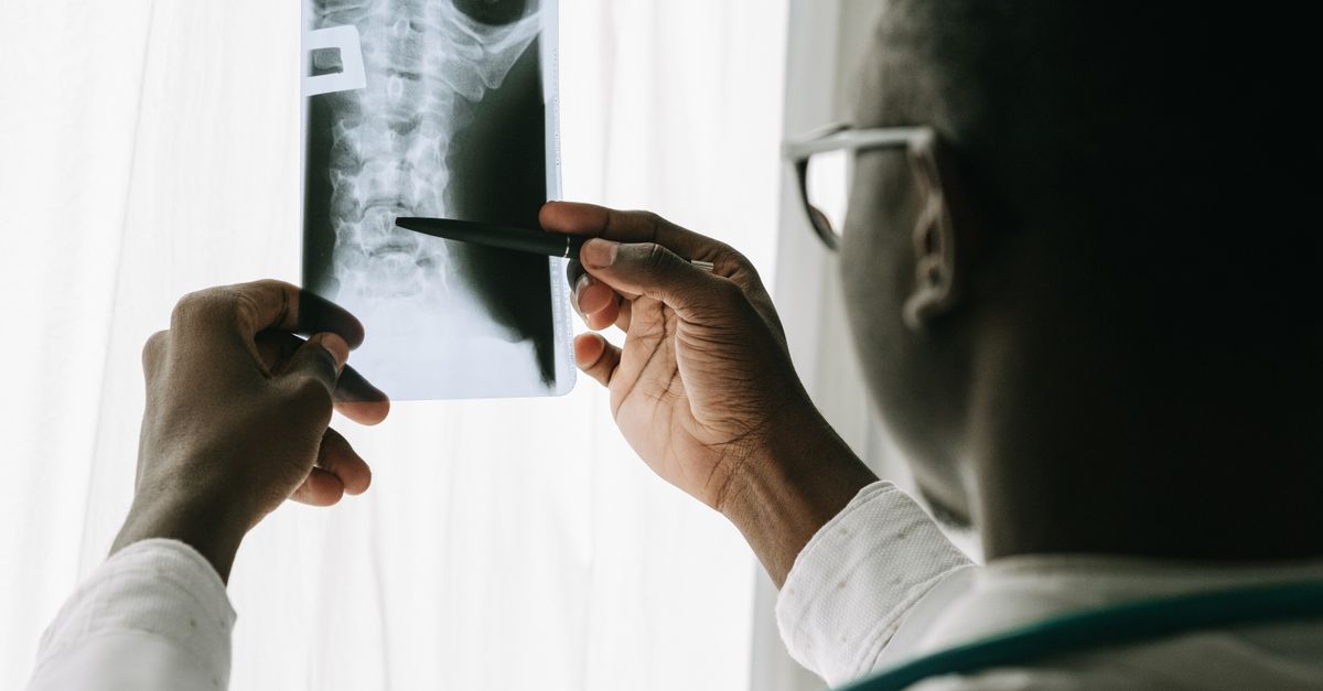 Close-up of a doctor examining a neck X-ray with a pen